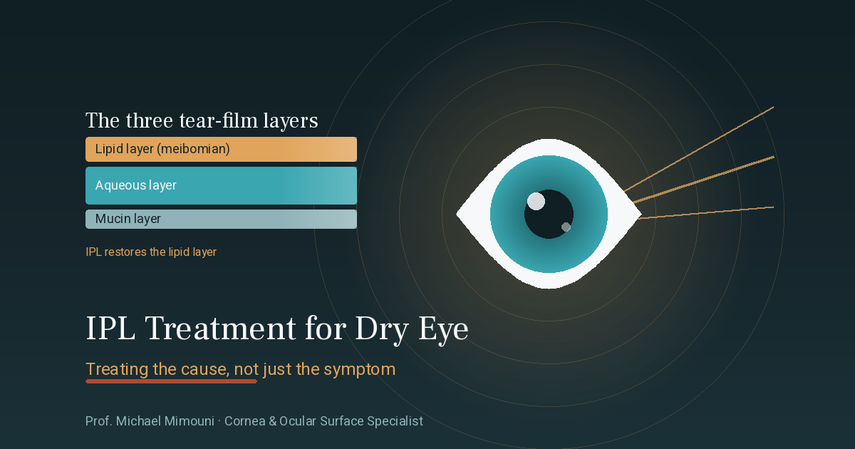 IPL Treatment for Dry Eye